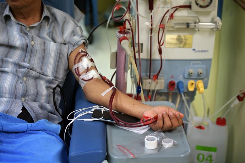 Kidney Dialysis